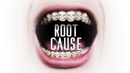 Root Cause